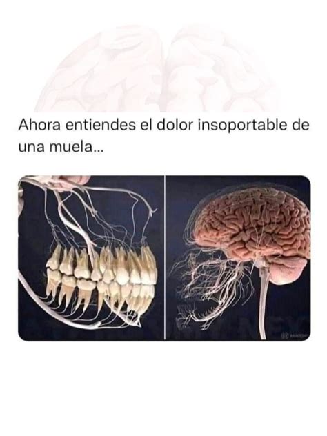 NEUROCRECER©️ | 🦷 ¿Por qué el dolor de muela puede sentirse tan ...