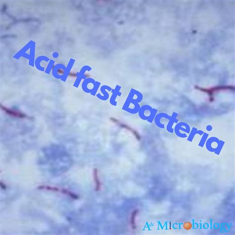 Acid fast Bacteria | Ask Microbiology
