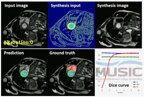 MICCAI2022|深圳大学医学部智能超声实验室6篇论文分享！-电子工程专辑