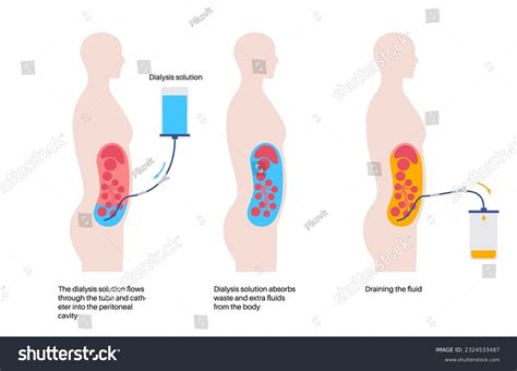 Peritoneum Anatomy Animation