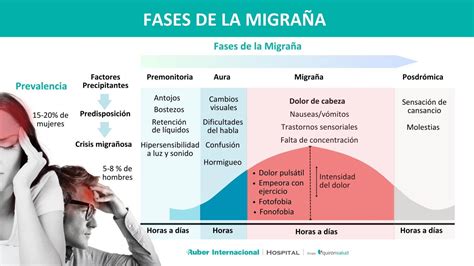 Migraña: causas, diagnóstico y tratamiento.