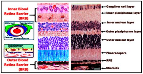 Implication of Hyperhomocysteinemia in Blood Retinal Barrier (BRB ...