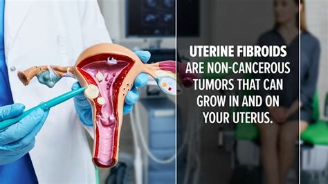 Cancerous Fibroids Symptoms What Are Uterine Fibroids? Its Causes And