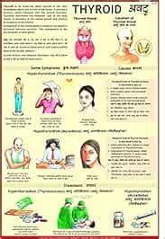 Thyroid Chart : Disease Charts, Vidya Chitr Prakashan: Amazon.in: Books