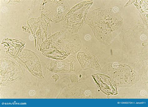 Epithelial Cells Under Microscope