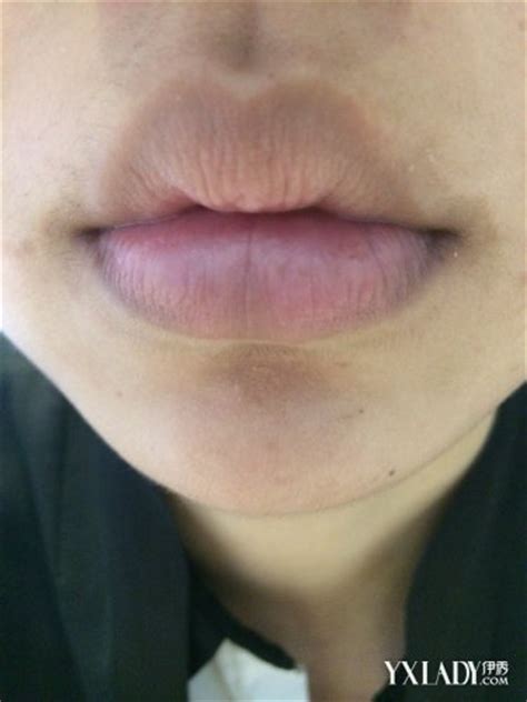 【图】嘴角发黑是什么原因 造成嘴角发黑的四个原因分析_嘴角发黑是什么原因_伊秀美容网|yxlady.com