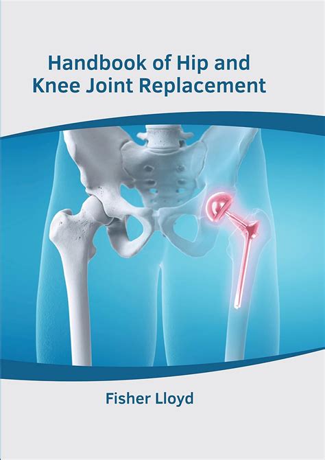 Handbook of Hip and Knee Joint Replacement: Lloyd, Fisher ...
