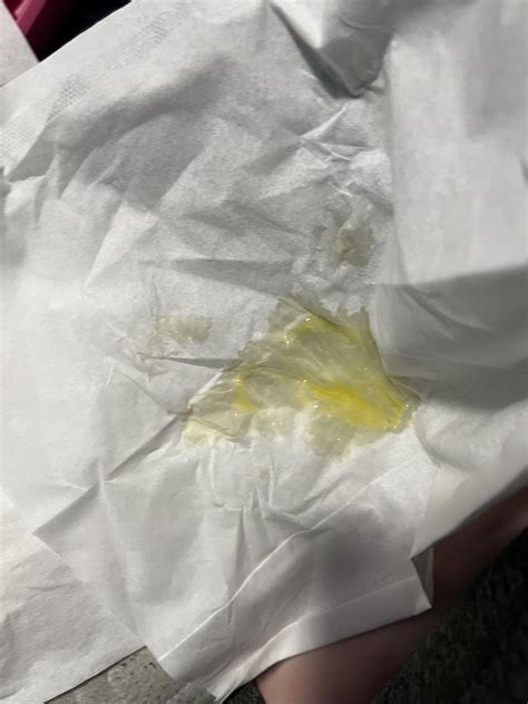 In the last ten minutes my snot has turned neon yellow : r/medical_advice