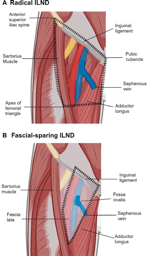 Groin Dissection Anatomy