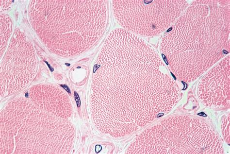 Image result for Skeletal Muscle Tissue Function