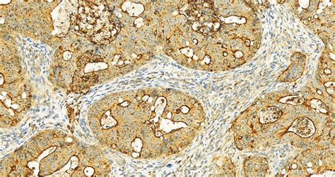 MUC13 antibody (55487-1-AP) | Proteintech