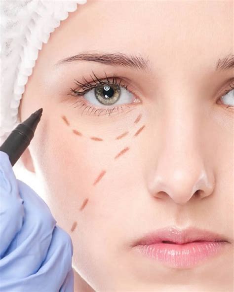 Under Eye Dark Circle Treatment | Eye Bag Treatment