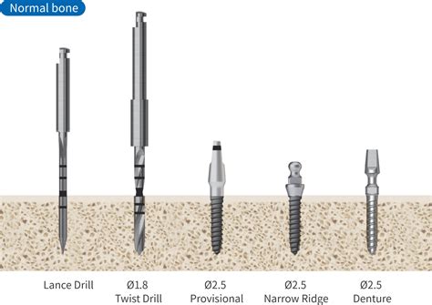 MS Kit - Hiossen® Implant