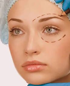 Best Eye Hospital Ghaziabad | Lasik Surgery | Cataract Surgery ...