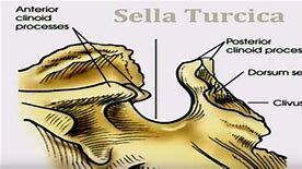 sella turcica 的图像结果