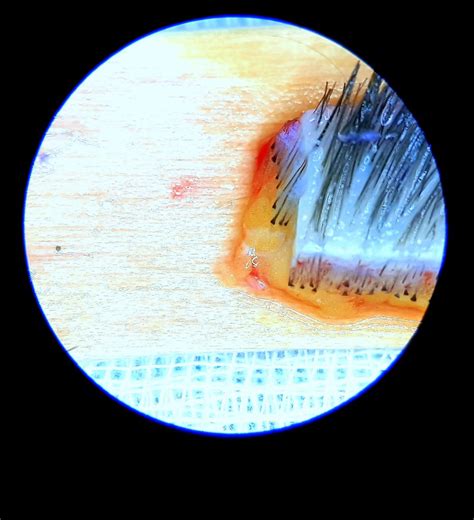 Photo Gallery - Dr. Sandip Agrawal