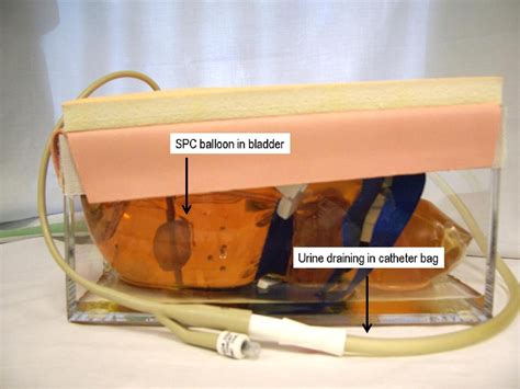 A Training Model for Suprapubic Catheter Insertion: The UroEmerge™ Suprapubic Catheter Model ...