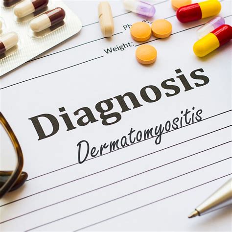 La dermatomyosite – une maladie systémique - Médecine interne ...
