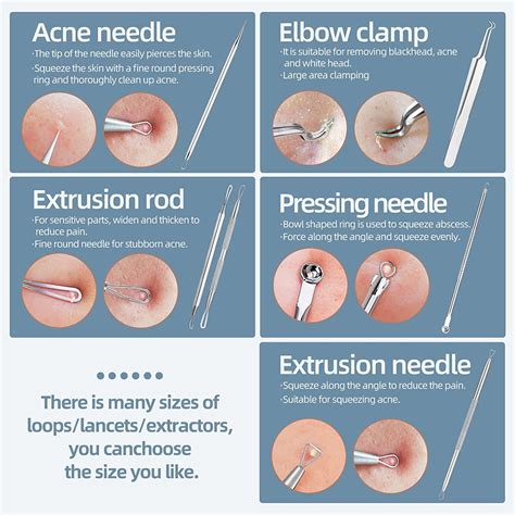 How To Blackhead Remover