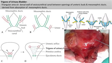 Development of urogenital system I | PPTX