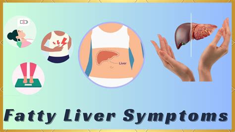 Fatty Liver Symptoms - Medinutrica