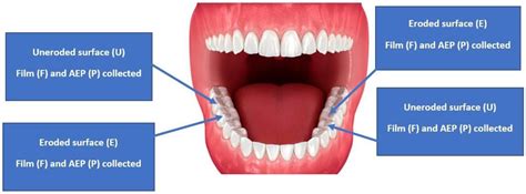 Salivary Proteins in Human Acquired Enamel Pellicle (AEP) on Eroded and ...