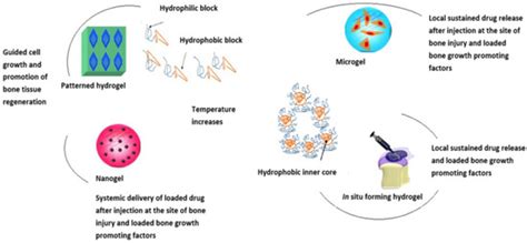 A Review of Injectable Polymeric Hydrogel Systems for Application in ...