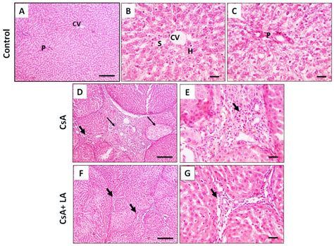 α-Lipoic Acid Protects against Cyclosporine A-Induced Hepatic Toxicity ...