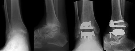 Hardware Monitor Driver 的图像结果