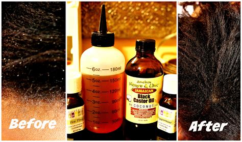 How To Get Rid Of Dandruff – My DIY Mixture For Getting Rid Of Dandruff – The Style News Network
