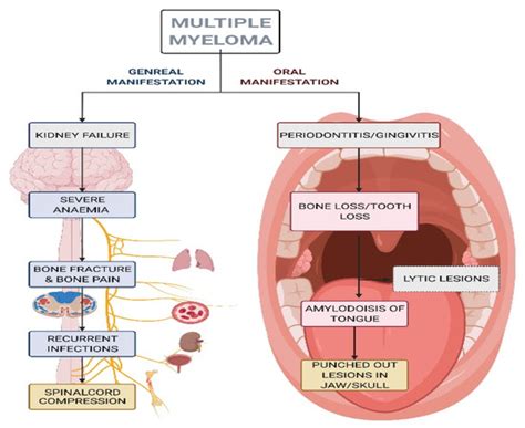 Periodontitis and Its Inflammatory Changes Linked to Various Systemic ...