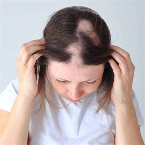 Dermatologist in Chembur | Roots clinic