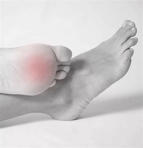Ball of Foot Pain Running 的图像结果