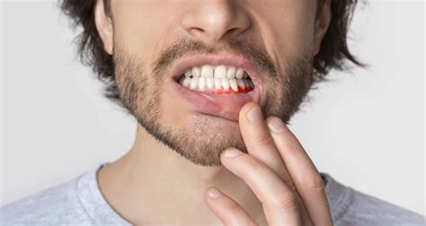 3 Effective Ways To Prevent Receding Gum Lines | Hendersonville Family Dental