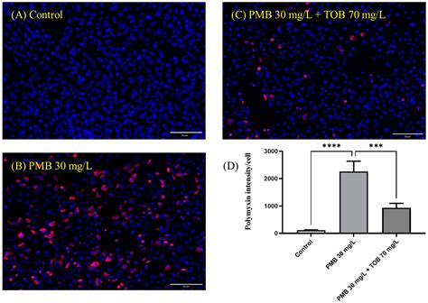Tobramycin Reduces Pulmonary Toxicity of Polymyxin B via Inhibiting the ...