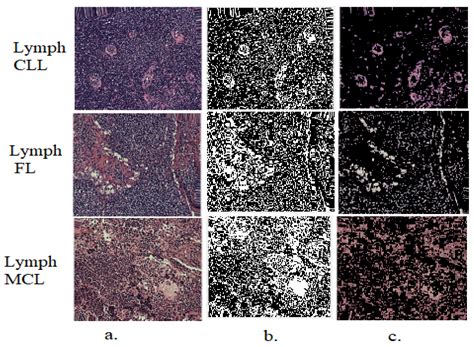 Hybrid Models Based on Fusion Features of a CNN and Handcrafted ...