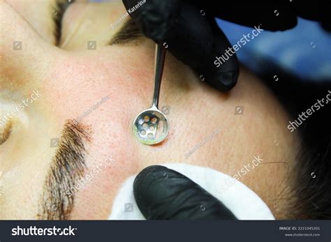 Skin pollution: Lebih dari 6.677 Foto Stok yang Dapat Dibeli Lisensinya ...