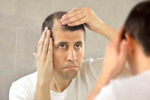 Signs and Symptoms of Hair Loss (Infographic)