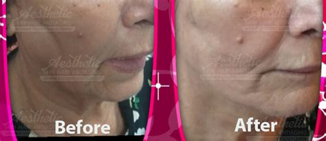 Aesthetic Cosmetology Centre