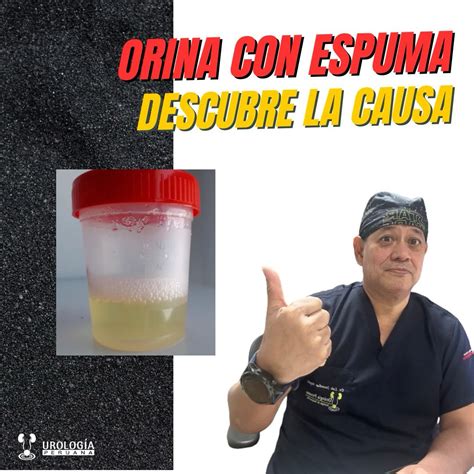 ¿Orinas con espuma? podría ser proteinuria y esto es lo que debes saber – Urología Peruana. Dr ...