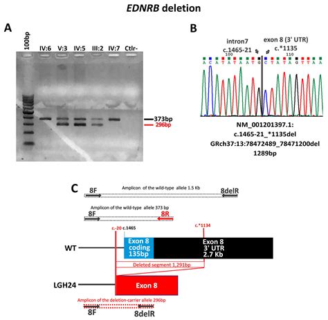 Waardenburg Syndrome: The Contribution of Next-Generation Sequencing to ...