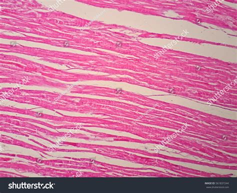 Histology Human Cardiac Muscle Under Microscope Stock Photo (Edit Now ...