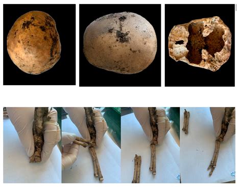 From Jane Doe to Sofia: DNA Extraction Protocol from Bones and Teeth ...
