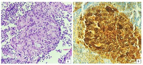 IJPO - Indian J Pathol Oncol