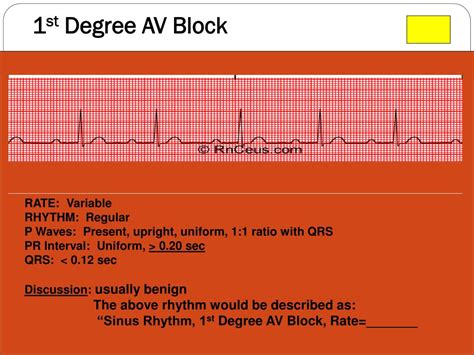 Image result for ACLS Code Blue Algorithm