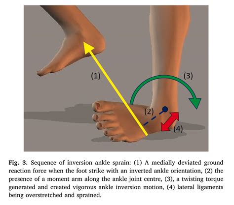 Ankle Inversion