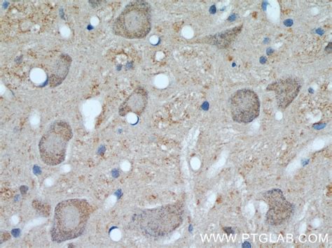 UCP1 antibody (23673-1-AP) | Proteintech