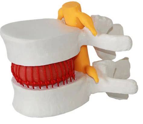 Disk Problem 的图像结果