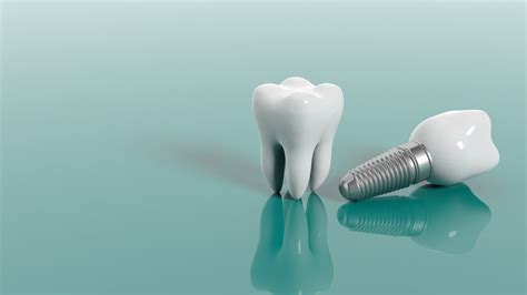 Dental Implant 101: Are Dental Implants Safe? - Arizona Periodontal Group