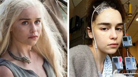 Emilia Clarke Opens Up About Her Aneurysms And Brain Surgeries; What Is ...